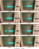 B3-B4_BDx.png